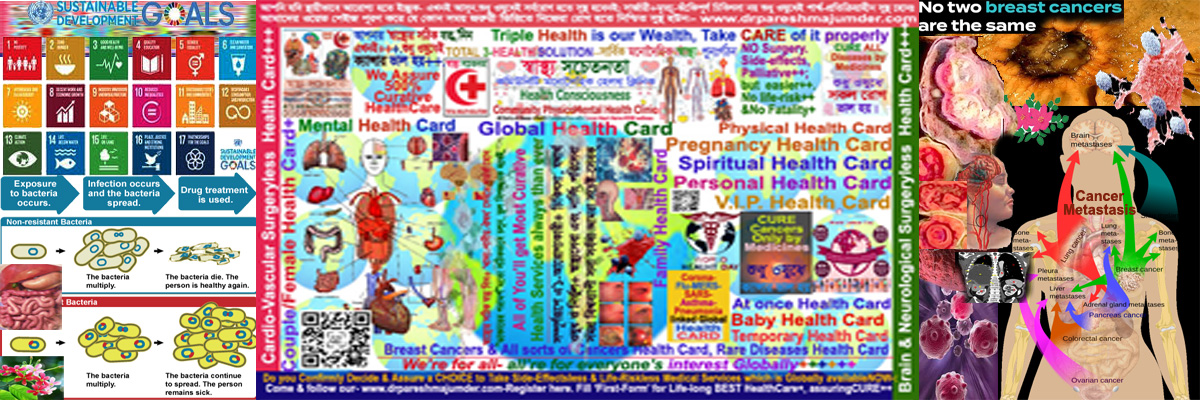 .Spreading to ALL ORGANS step by step with "No Curative Health Services Globally Billion-Trillion Dollars-Pounds investment to Protect-Palliate-Prevent Temporarily only.